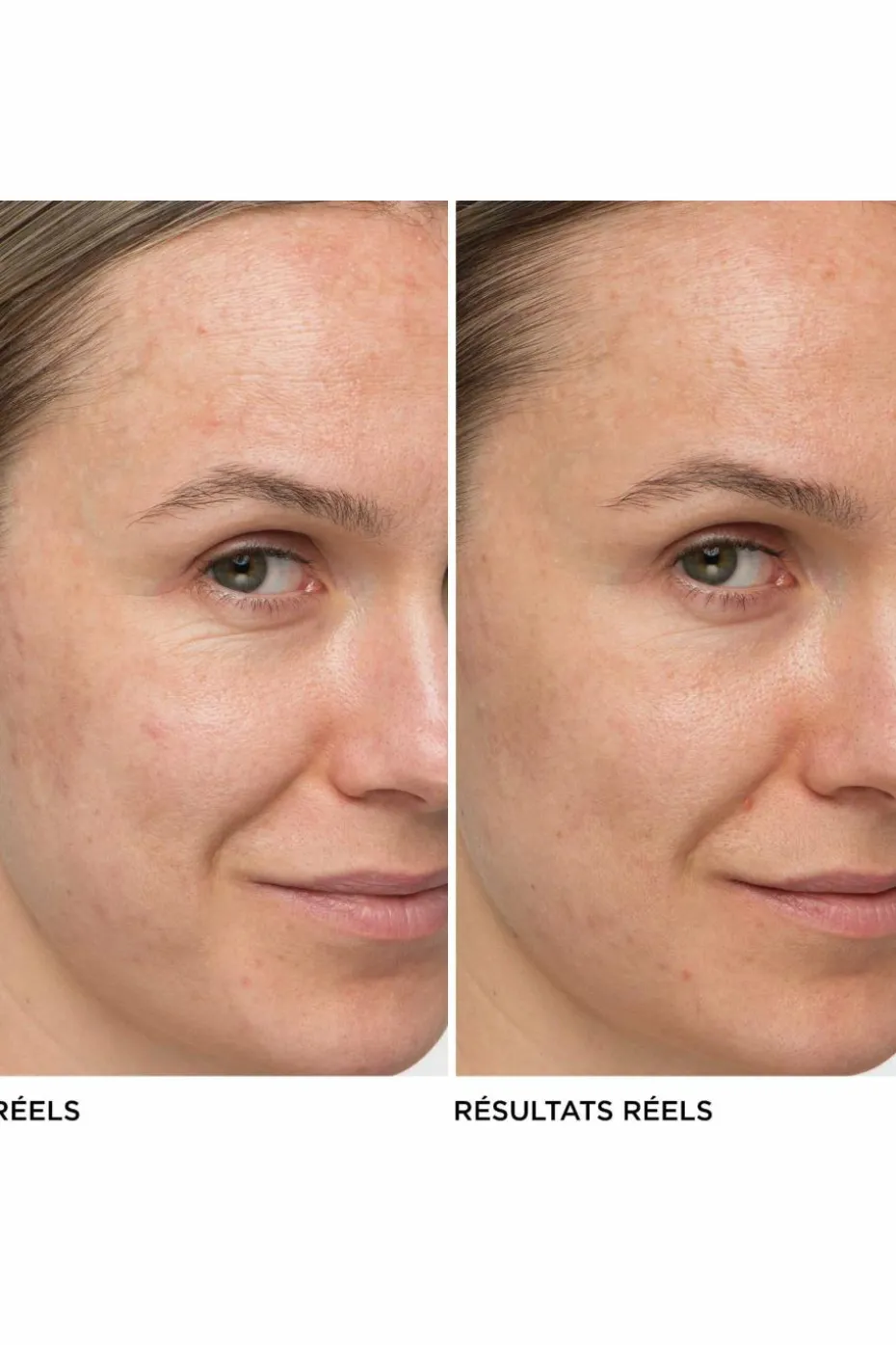 Crème anti-âge hydratante Confidence in a Cream™