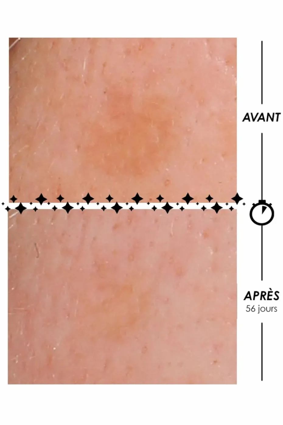 Crème lactée anti-taches La Foudroyante Eclair de Lune à l’advanced Retinol-Like