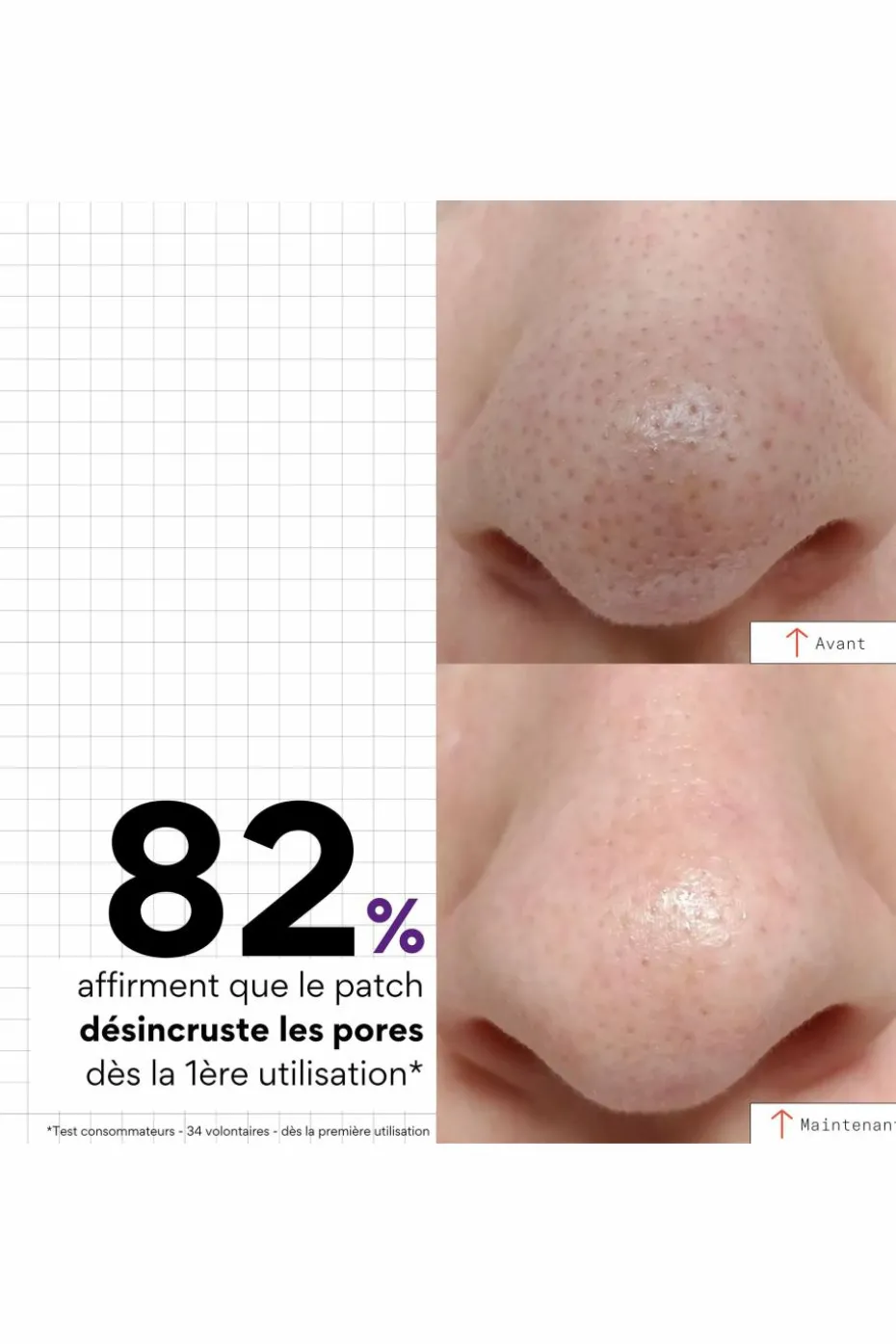 Patchs nez purifiants Peel out