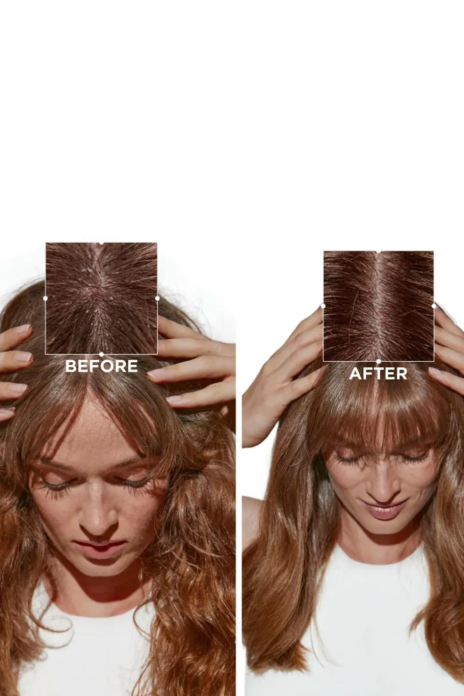 Sérum cellulaire nuit anti-pelliculaire intensif Symbiose